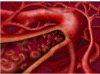 The Lymphatic & Lymph