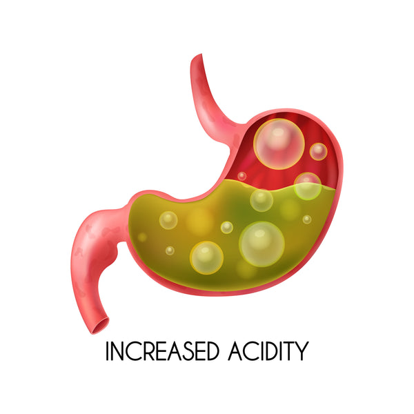 Acid Reflux