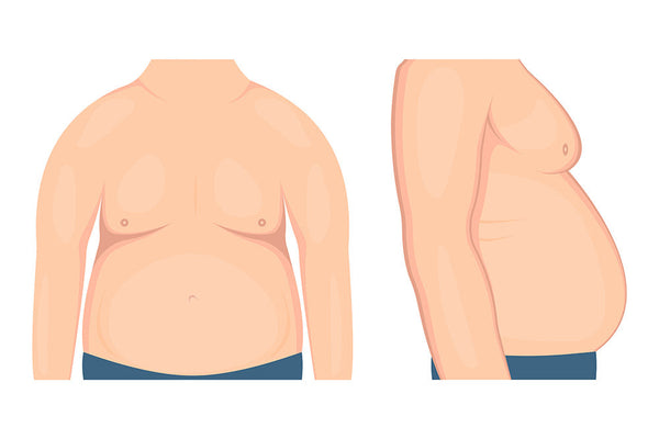 Gynecomastia - Man Boobs