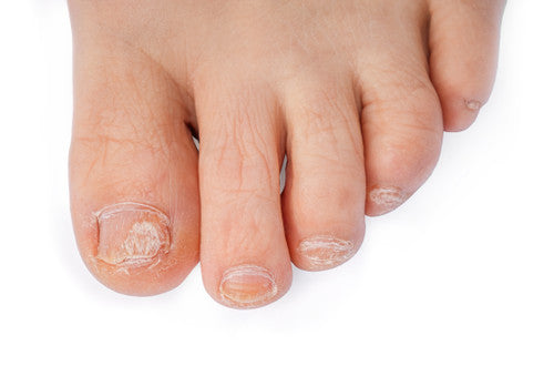 Therapeutic Nail Oil (15 ml)